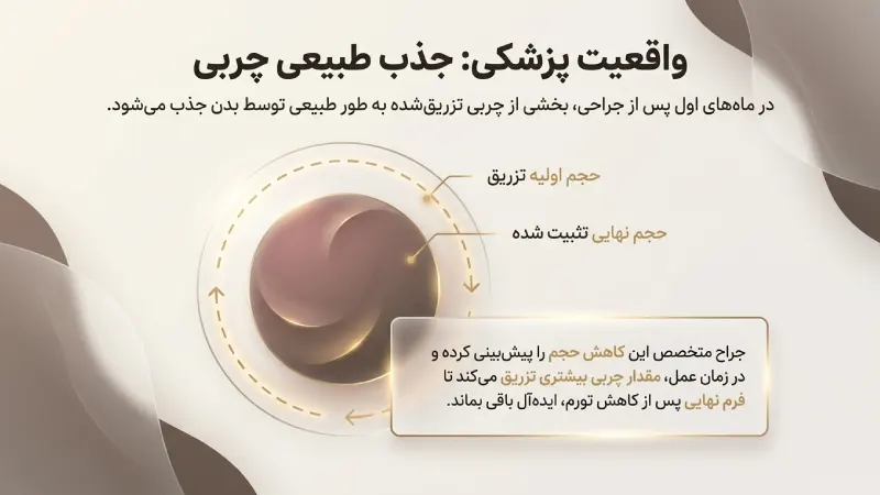 BBL چگونه انجام می‌شود؟