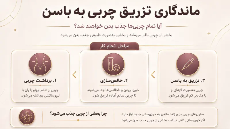 آیا ماندگاری تزریق چربی به باسن دائمی‌ست؟