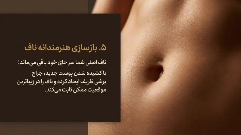 تغییر موقعیت و بازسازی ناف در جراحی تامی تاک