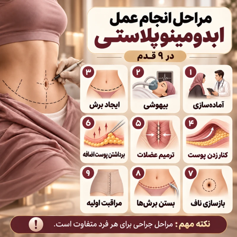 مراحل انجام عمل ابدومینوپلاستی از صفر تا صد؛ در اتاق عمل چه می‌گذرد؟