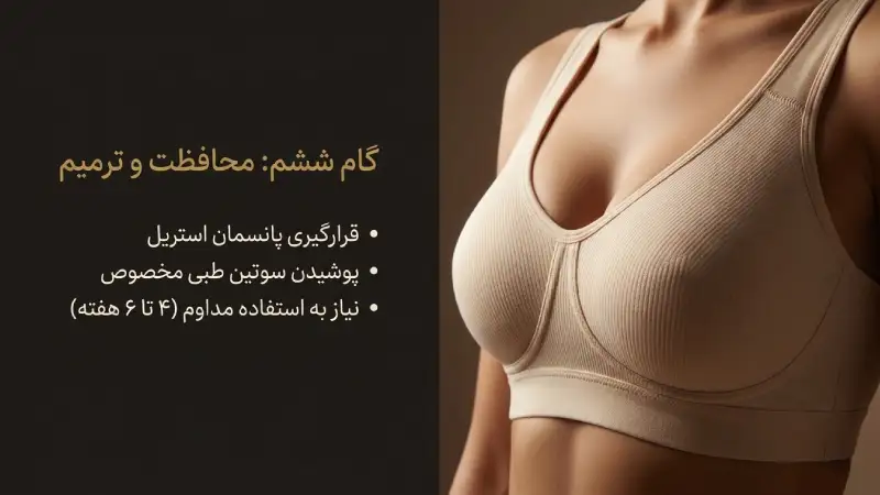 پانسمان و پوشیدن سوتین مخصوص بعد از ماموپلاستی